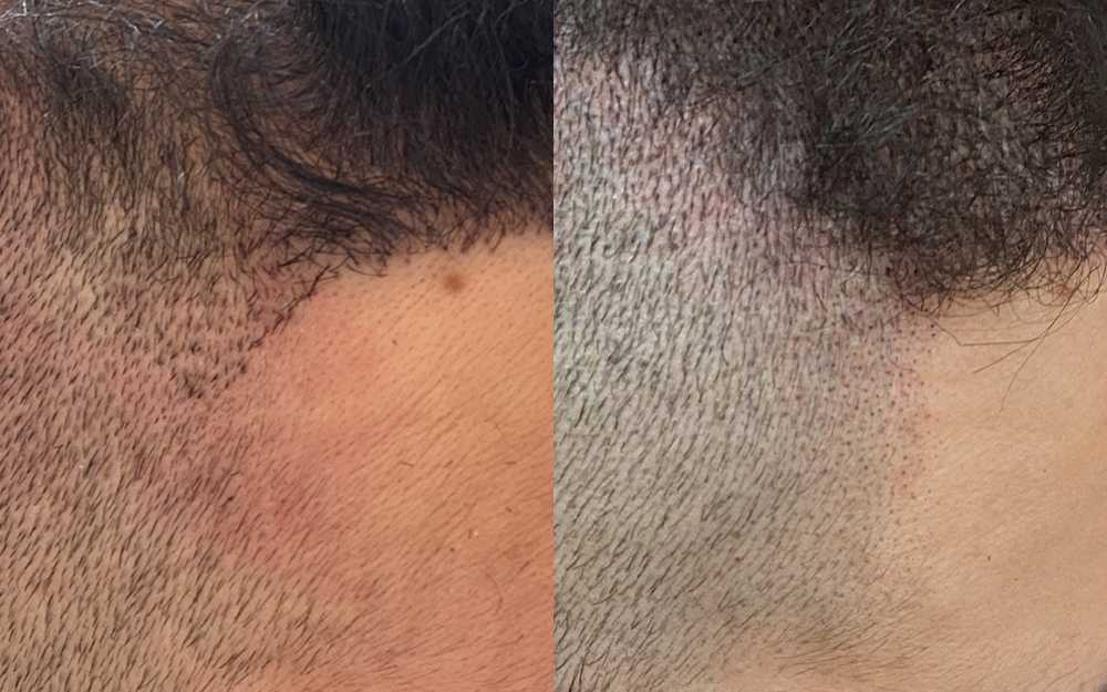 Before & After June 2023 #4
